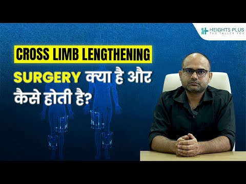 Cross-Limb Lengthening surgery क्या है और कैसे होती है?