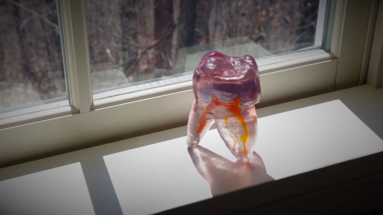 Endodontic Care Video