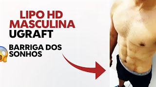 ANTES E DEPOIS LIPO HD MASCULINA - LIPO HD UGRAFT