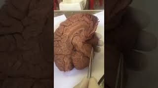 Dr Medhat - Brainstem + medial surface