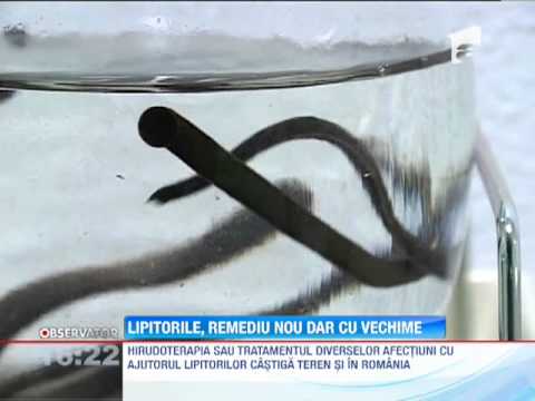 Hirudoterapie pentru revizuirile varicose, Forum de revizuire anti-varicose gumă cremă