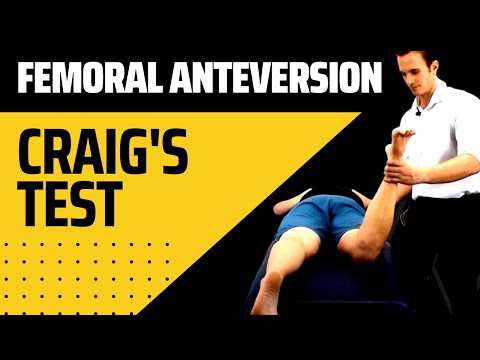 Femoral Anteversion Retroversion Craig's Hip Test