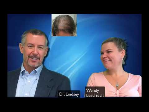 Female hair transplant results all the way from Italy by Dr. Lindsey in DC | McLean | Washington thumbnail