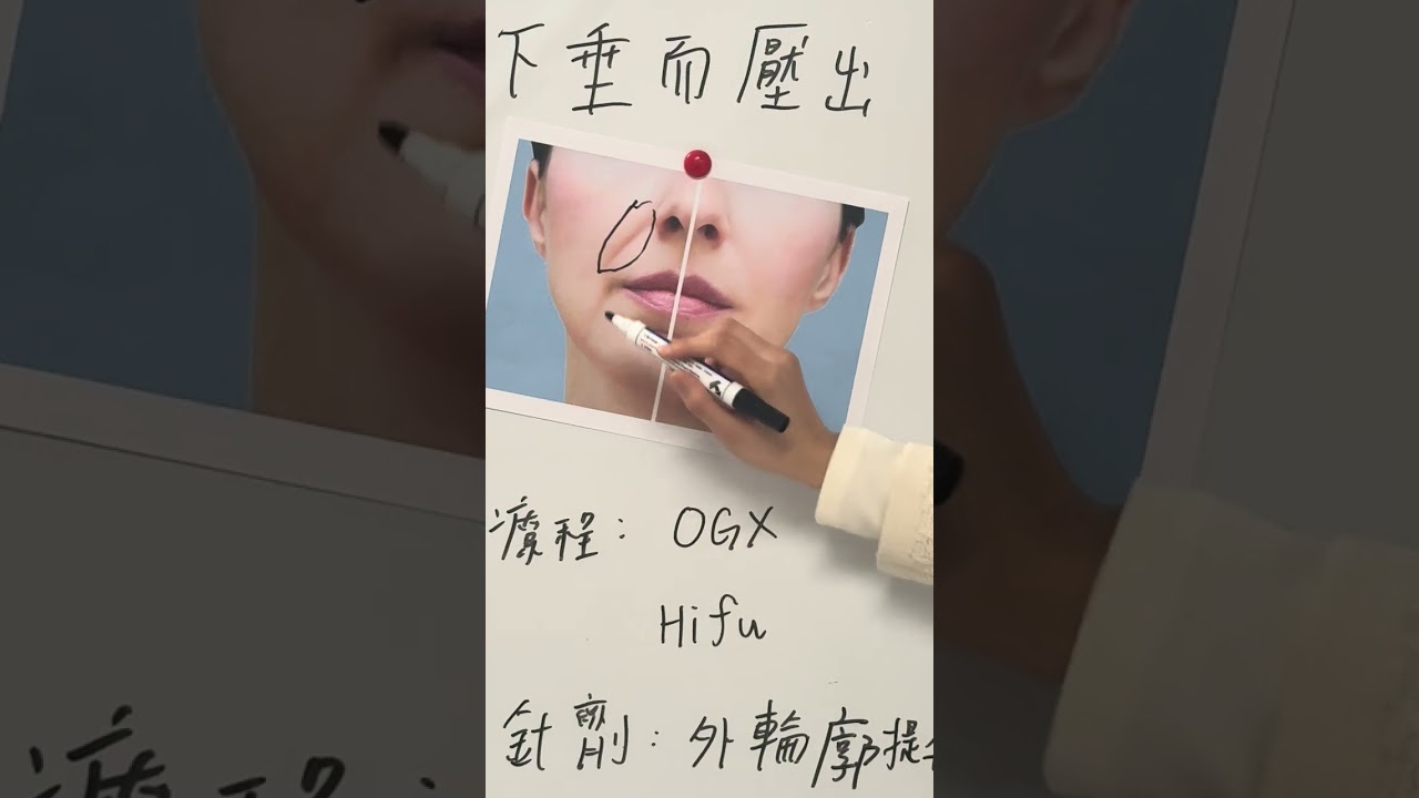 虎紋點解決