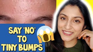 7 Days Challenge 😲 Treat TINY BUMPS on FOREHEADS/FACE NATURALLY | 100% Works Home Remedy