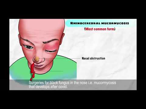 Neptune ENT Hospital Miraj | नेपच्यून ईएनटी हॉस्पिटल मिरज |