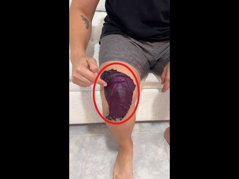 This Cabbage Trick Fixed My Mom's Knee Pain