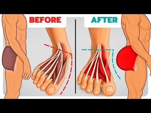 How Strong Glutes Fix Flat Feet & Weak Ankles (Science-Based)