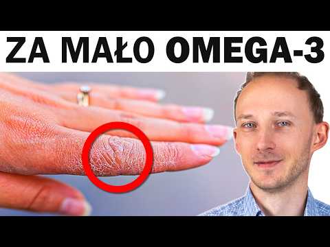 6 oznak, że brakuje Ci OMEGA-3