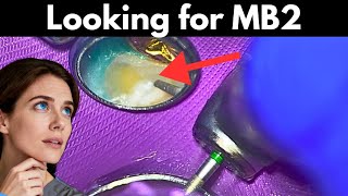 MB2 Troughing Video for Student