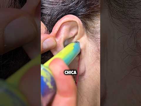 . Casi Perdió La Audición Por Usar Auriculares 😳