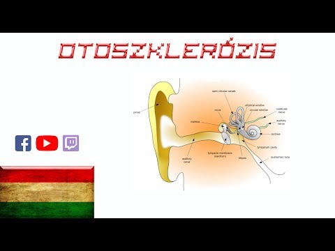 nyaki osteochondrozis fülzaj gyógyszeres kezelése)