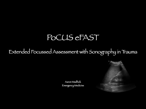 e-FAST PoCUS - Focussed assessment with Sonography in Trauma
