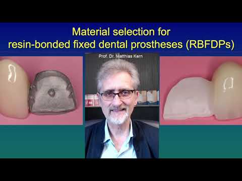 Materials selection for resin-bonded fixed dental prostheses (RBFDPs)