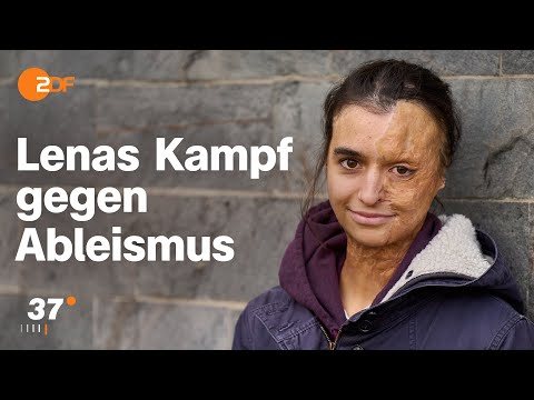 Vom Blitz getroffen: Was Lena nach dem Schicksalsschlag wichtig ist I 37 Grad