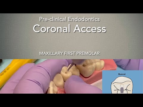 Dostęp endodontyczny - pierwszy przedtrzonowiec szczęki