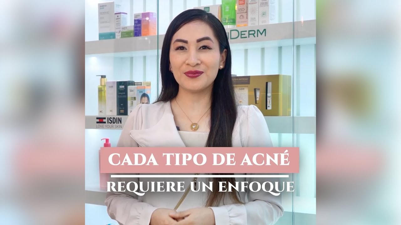 Tipos de Acné - Dra. Gisela Pilar Aire Farfán