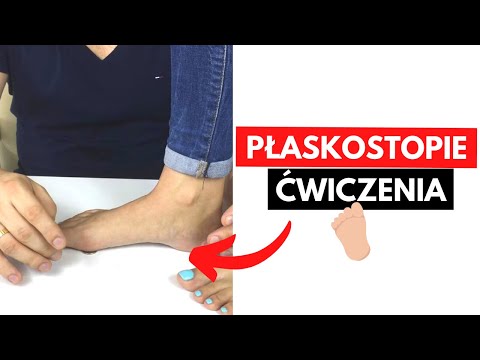 Plano deformacja koślawego piszczel Kości na dużym żelu toe