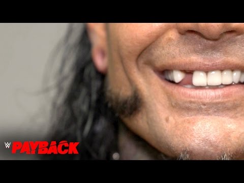 Jeff Hardy Is Broken … At Least His Tooth Is