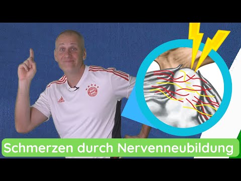 Bandscheibenvorfall (Prolaps) - Schmerzen durch Nervenneubildung