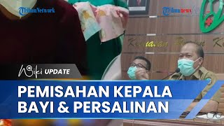 Klarifikasi soal Prosedur Operasi Pemisahan Kepala Bayi Demi Selamatkan Ibu, RSUD Jombang Buka Suara
