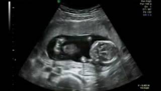 In the womb, awesome 13 weeks pregnancy. Background music: Jesu Joy of Man's Desiring by Bach
