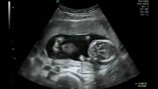 In the womb, awesome 13 weeks pregnancy. Background music: Jesu Joy of Man's Desiring by Bach