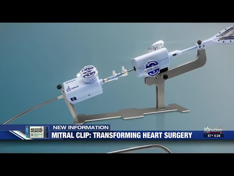 Medical Moment: How the 'mitral clip' is transforming heart surgery