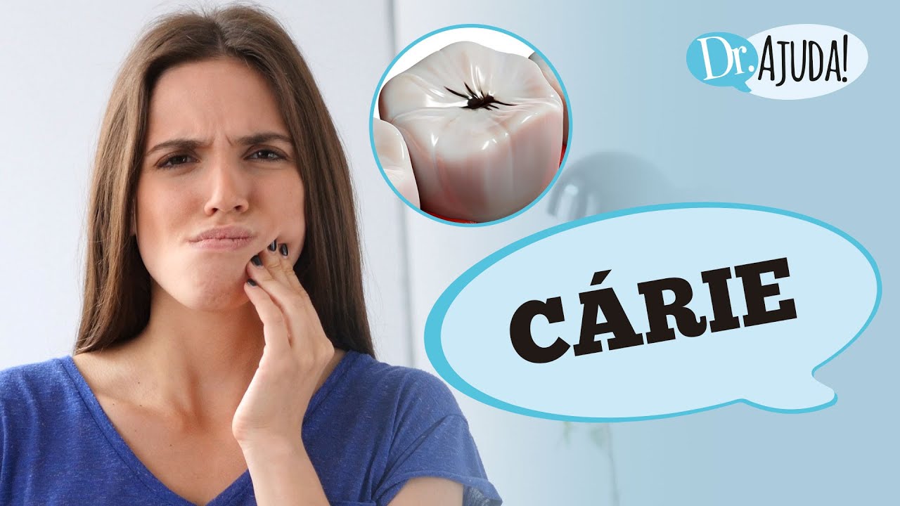 CÁRIE DENTÁRIA: COMO IDENTIFICAR, SINTOMAS, TRATAMENTO E PREVENÇÃO