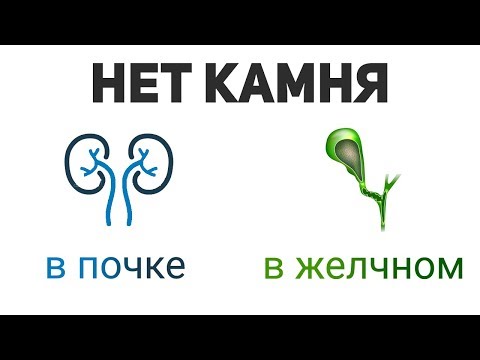 Hip kaufen Kharkiv Einfache Übungen für die Behandlung von degenerativen Bandscheibenerkrankungen