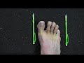Toe Spread