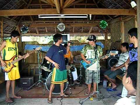 Cal-lay Band/Stitches and Burns