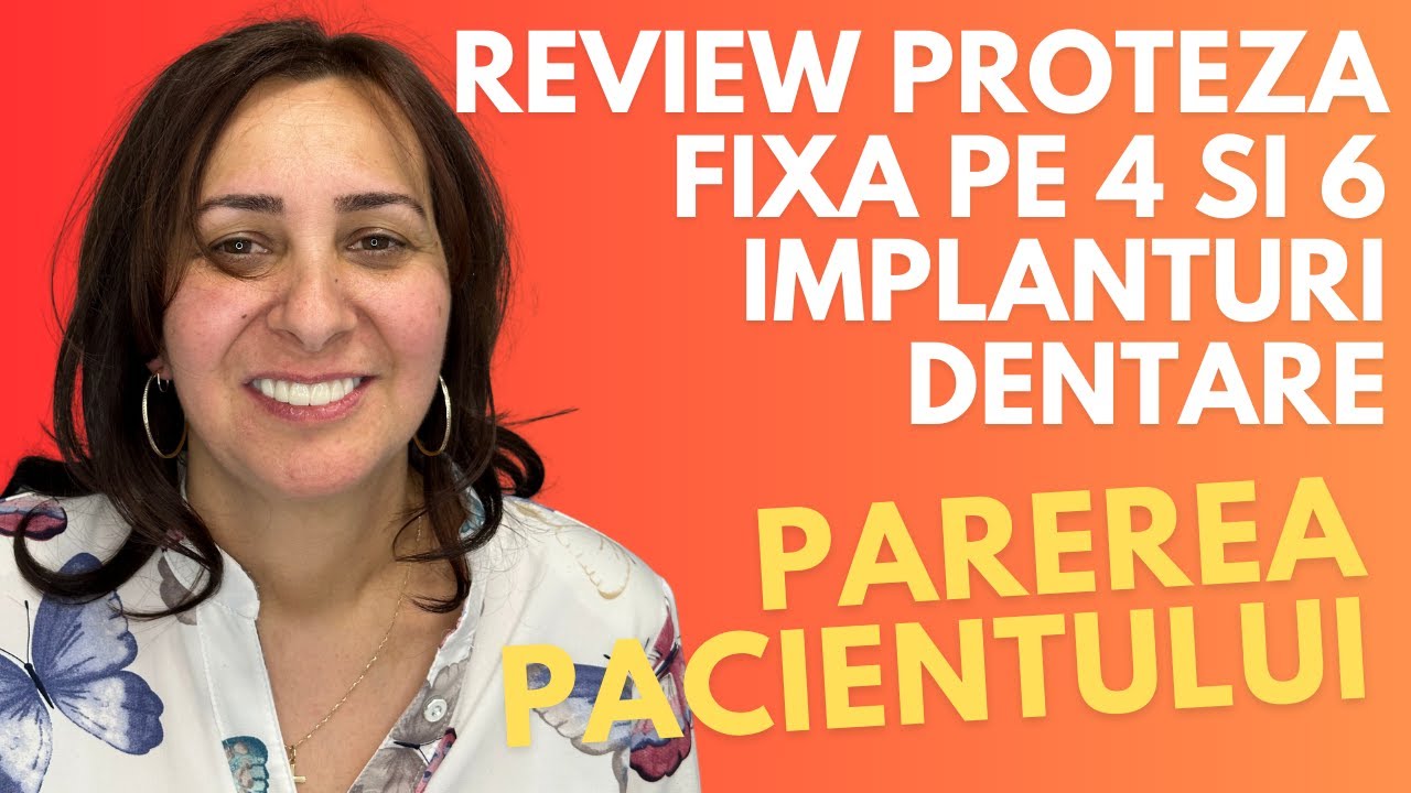 Review Proteza Fixa pe 4 si 6 Implanturi Dentare | Parere Pacient Implant Dentar