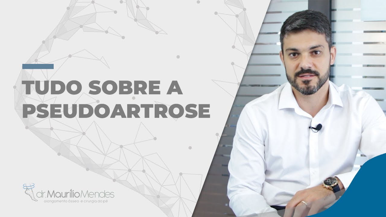 Tudo sobre a Pseudoartrose