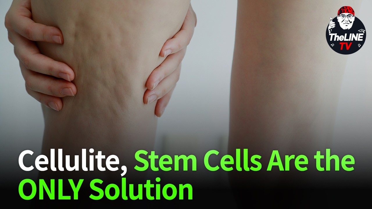 Stem cell cellulite treatment - TheLINE Plastic Surgery video