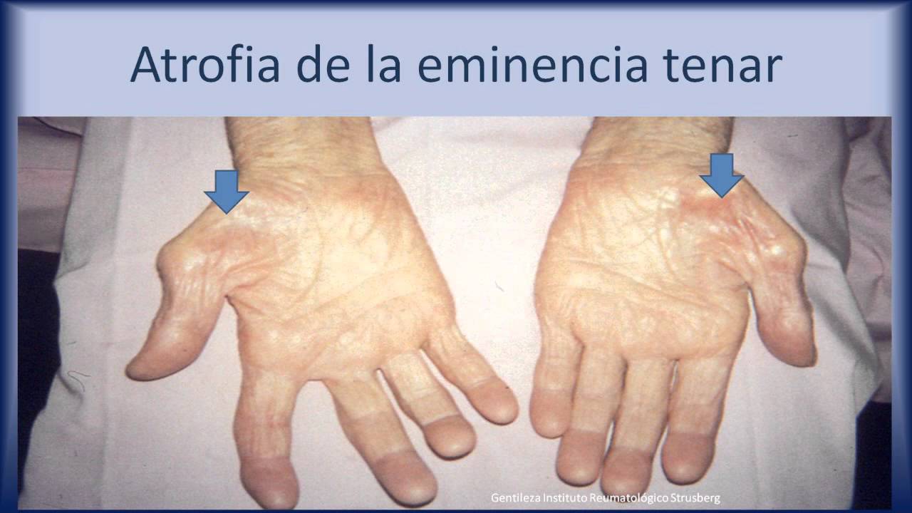 Examen físico osteoarticular - Cátedra de Semiología UHMI Nº2