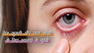 Simple Home Remedies for Eye Infection | आंखों में हुए संक्रमण को दूर करने में मदद करेंगे ये नुस्खे