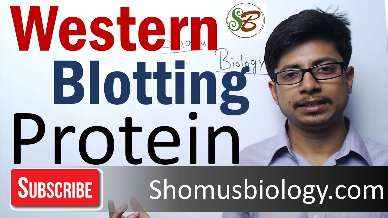 Western blotting technique | principle and step by step procedure