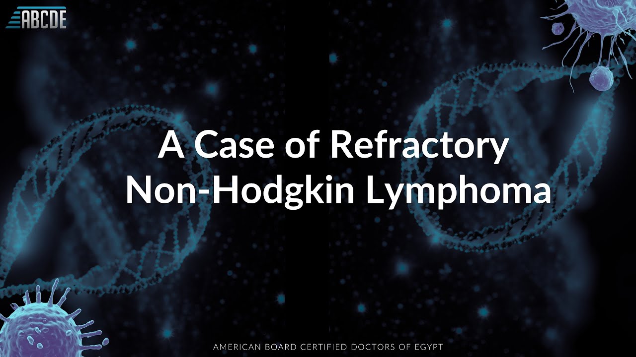 When Lymphoma Fights Back: Managing a Tough Refractory NHL Case | ABCDE Tumor Board