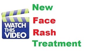 How To Get Rid of Face Rash At Home