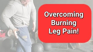 Burning Leg Pain - How I Fixed It