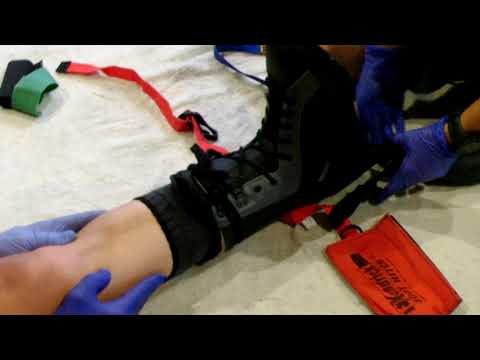 20-7 Traction Splinting