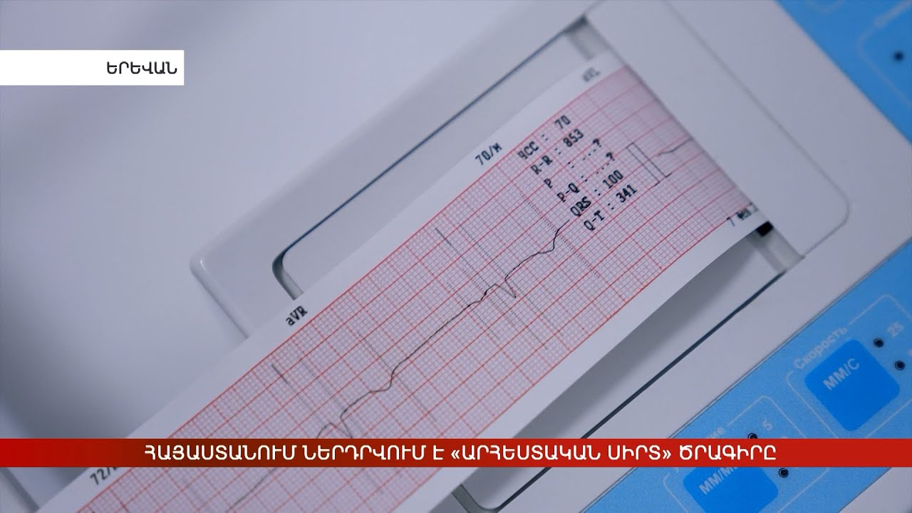 Հայաստանում կներդրվի «Արհեստական սիրտ» ծրագիրը