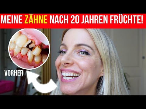 No dentist will tell you that! This is how I saved my teeth and gums