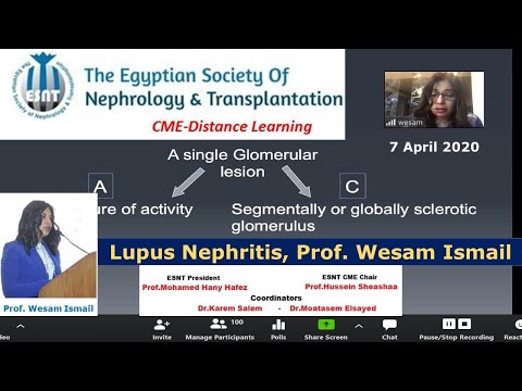 Lupus nephritis  Prof  Wesam Ismail, 7 April 2020