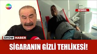 Buerger hastalarına yapay zekalı çözüm!