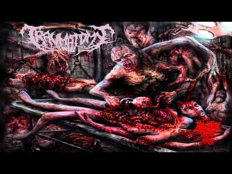 Traumatomy - Beneficial Amputation Excess Limbs (2014) {Full-EP}