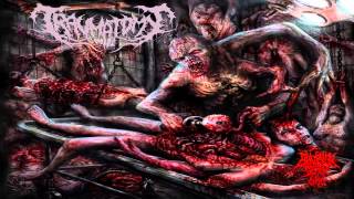 Traumatomy - Beneficial Amputation Excess Limbs (2014) {Full-EP}