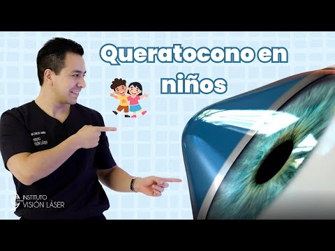 Queratocono en niños