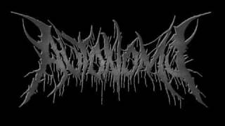 Autonomy- Renounced Posterity